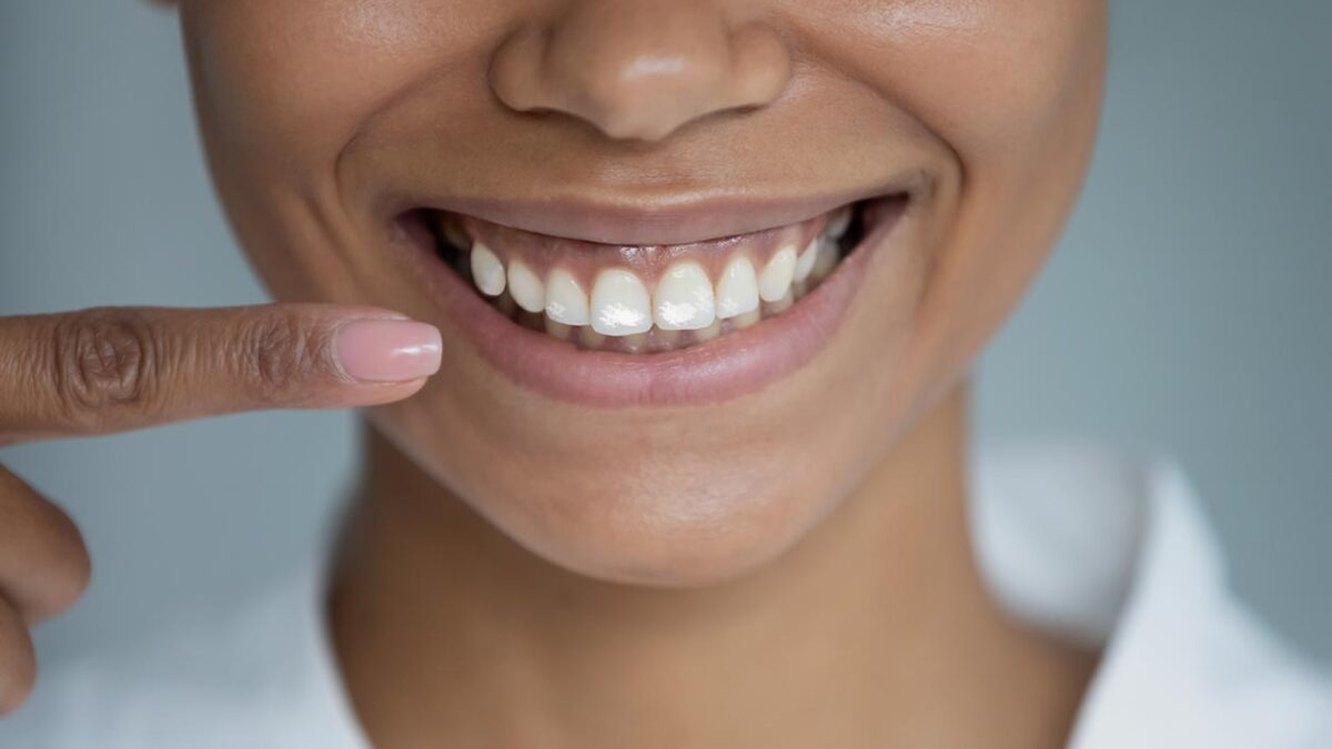 taches blanches sur les dents