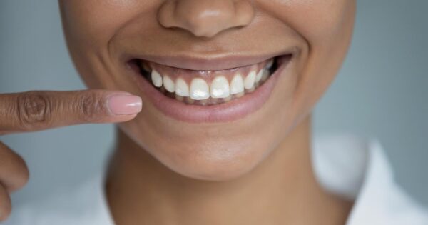 taches blanches sur les dents