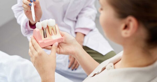 procédure d'implant dentaire expliquée