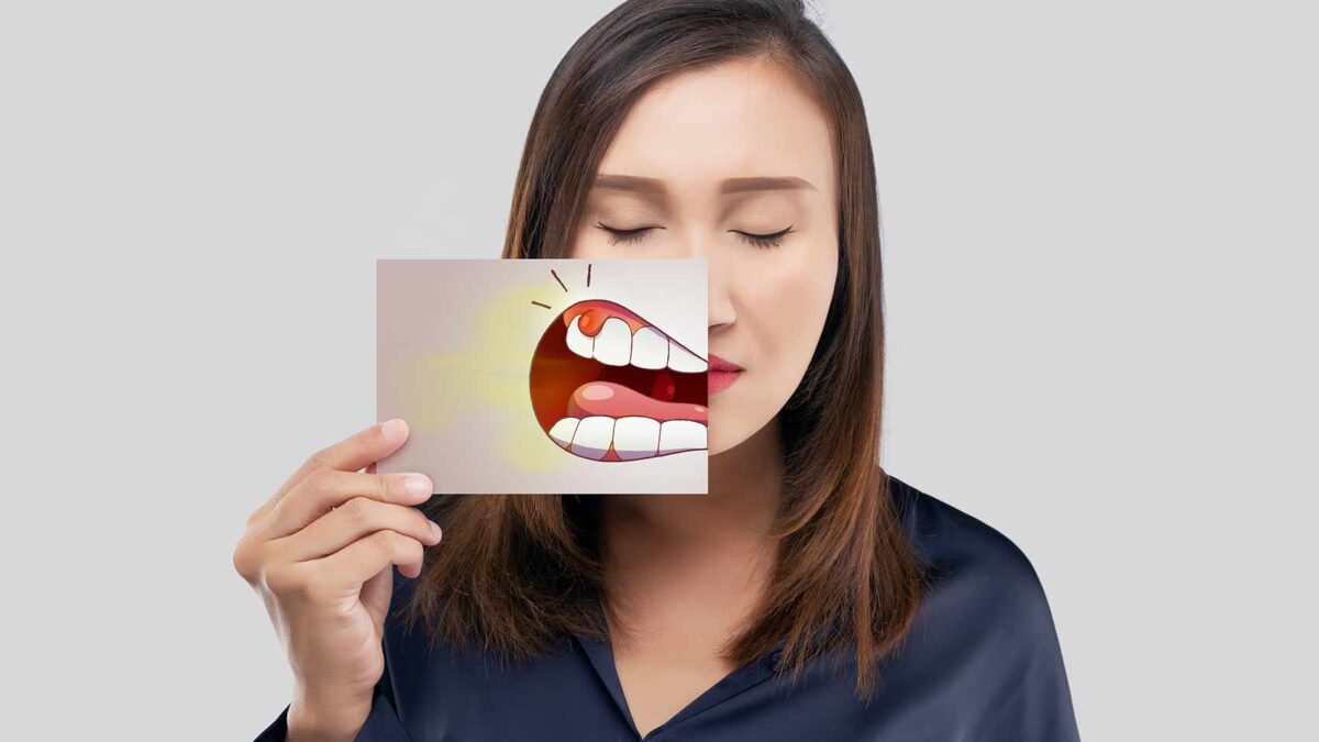 abcès dentaire ou gingival