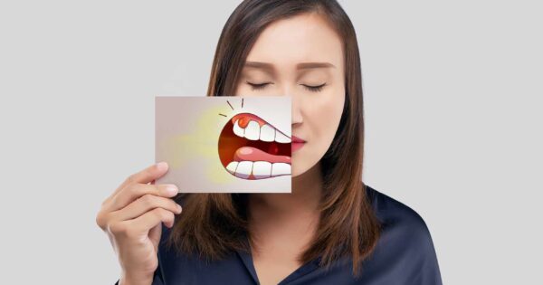 abcès dentaire ou gingival